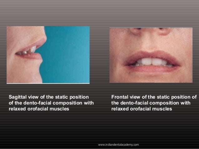 Not pay median sagittal facial segment Median sagittal facial segment question